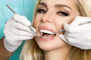 I Get Affordable Veneers in Dubai