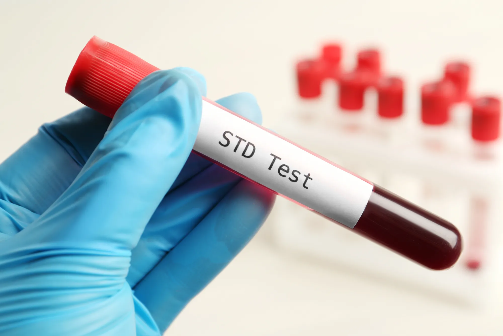 Guide to Convenient STD Testing in Dubai